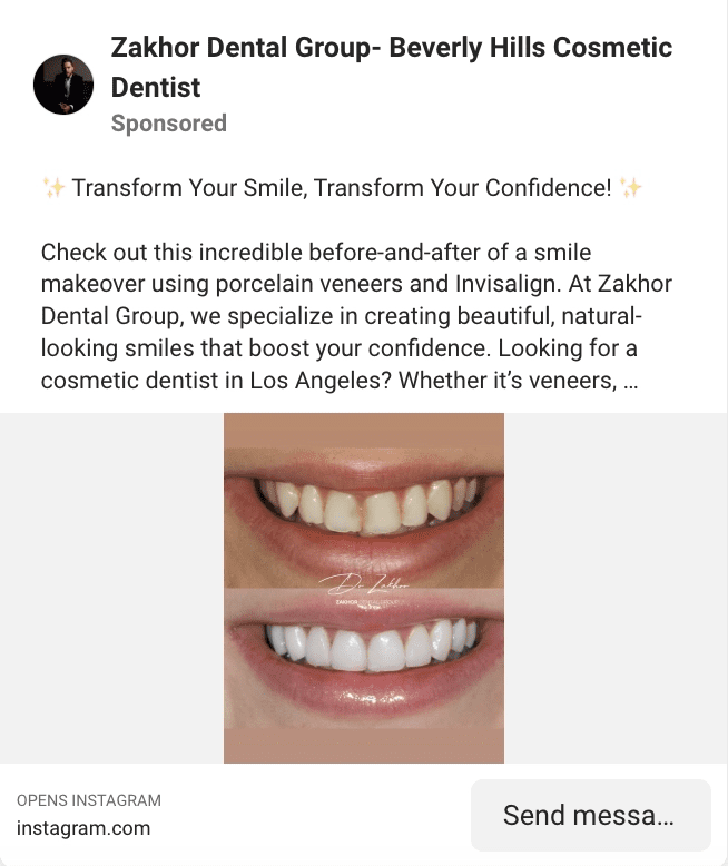 facebook ads for dental clinic